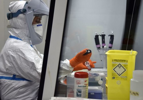 Бельгийский институт утверждает, что обнаружил антитело, которое может нейтрализовать коронавирус!